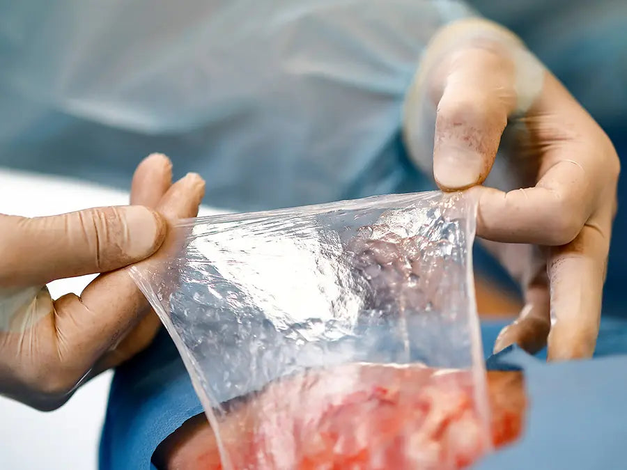 The transparent EPIPROTECT® membrane applied on a wound, conforming to the wound bed