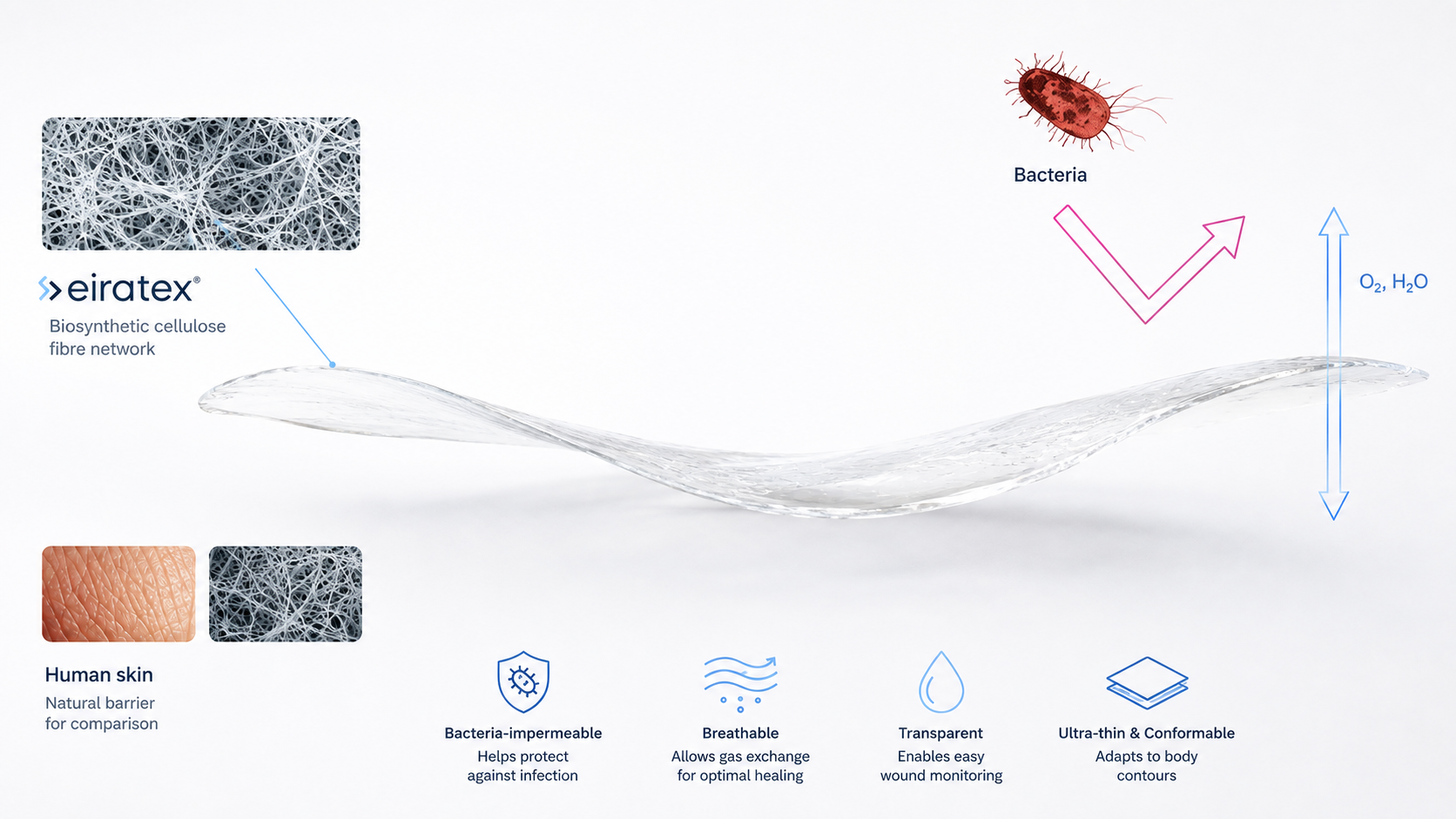 Diagram of the eiratex® membrane: a biosynthetic cellulose fibre network compared with human skin, impermeable to bacteria while allowing O2 and H2O exchange, transparent, ultra-thin and conformable